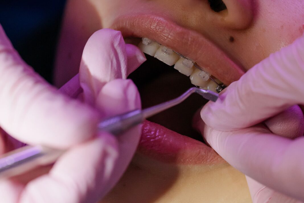 When Were Braces Invented The Real Story Behind Straight Teeth Were Braces Invented